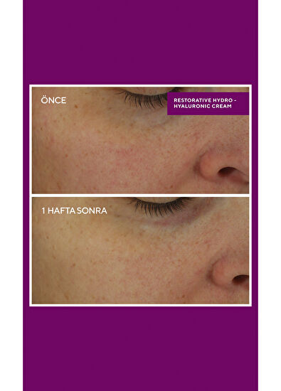 Murad Restorative Hydro-Hyaluronic Cream - Yoğun Onarıcı Ultra Güçlü Nemlendirici 50ML - 6