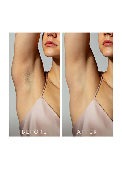 Foreo Peach 2 Ipl Hair Removal Device - 5