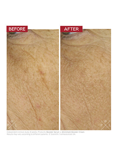 Dr.Levy Enriched Booster Cream 50 ml - 5