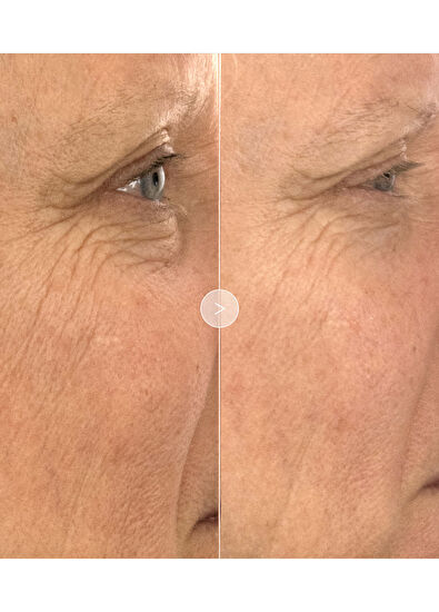 Noble Panacea The Absolute Restoring Eye Cream 30 Dose Refill - 5