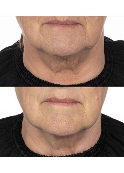 Noble Panacea The Absolute Peptide8 Night Serum 30 Dose - 5