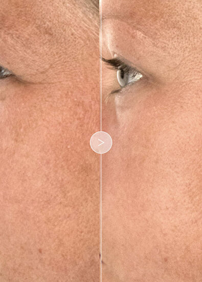 Noble Panacea The Brilliant Overnight Recharge Cream Refill - 5