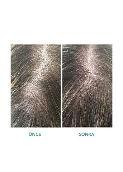 We Are Paradoxx Growth Thickening 250 ml Saç Kremi - 5