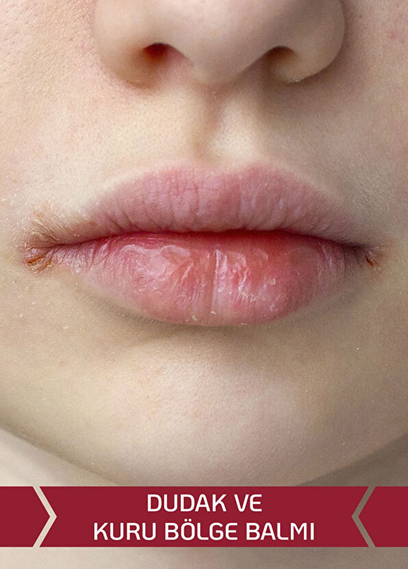 Decubal Basic Kuru ve Hassas Ciltler İçin Nemlendirici 2'li Krem Seti - 4