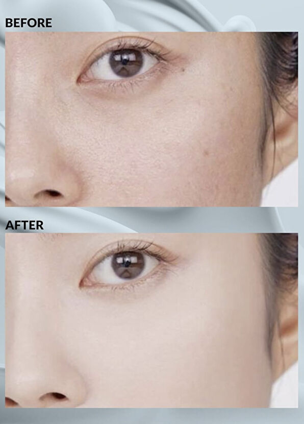 Terrazen Aqua Recharge 10'lu Nemlendirici Maske 27 ml - 4