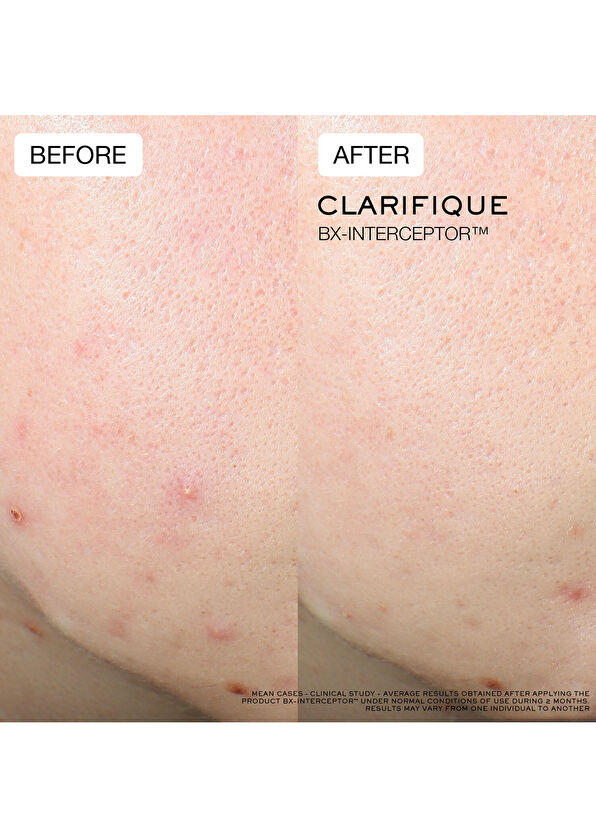 Lancome PEELING - 4