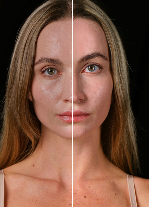 Foreo FAQ 402 Mikro Akımlı LEDli Sıkılaştırma - 4