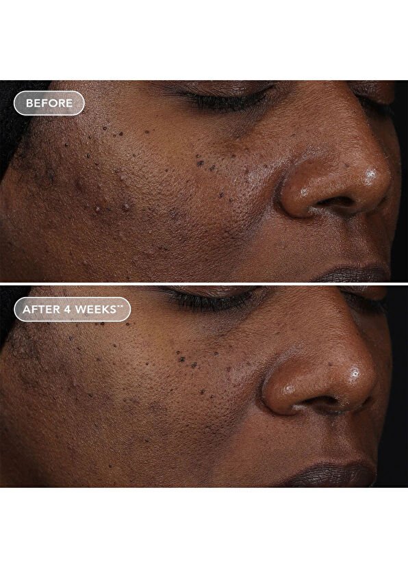 Image Skincare Ageless+ Retinol Repair Crème 0.3% Retinol Complex Anti-Aging Face Cream 50 g - 4