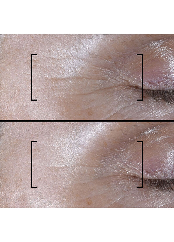 Filorga Time-filler Shot 5xp Kırışıklık Karşıtı Konsantre Serum 15 ml - 4