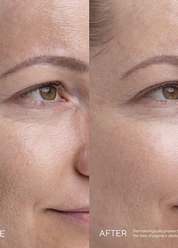 Mádara KOJIC ALTERNATIVE Kojic Acid Alternative Plant-Based Pigment Serum - 3