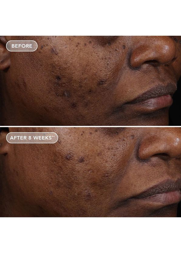 Image Skincare Ageless+ Retinol Treatment Crème 1.2% Retinol Complex Anti-Aging Face Cream 28.5 gr - 3