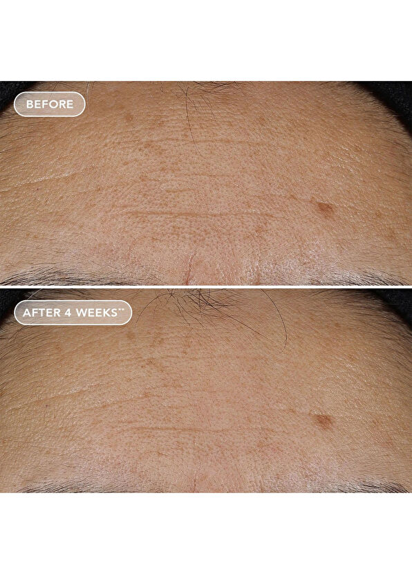 Image Skincare Ageless+ Retinol Repair Crème 0.3% Retinol Complex Anti-Aging Face Cream 50 g - 3