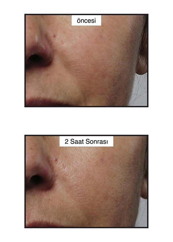 Murad Anında Sıkılaştırıcı Kolajen Serumu 30 ml - 2