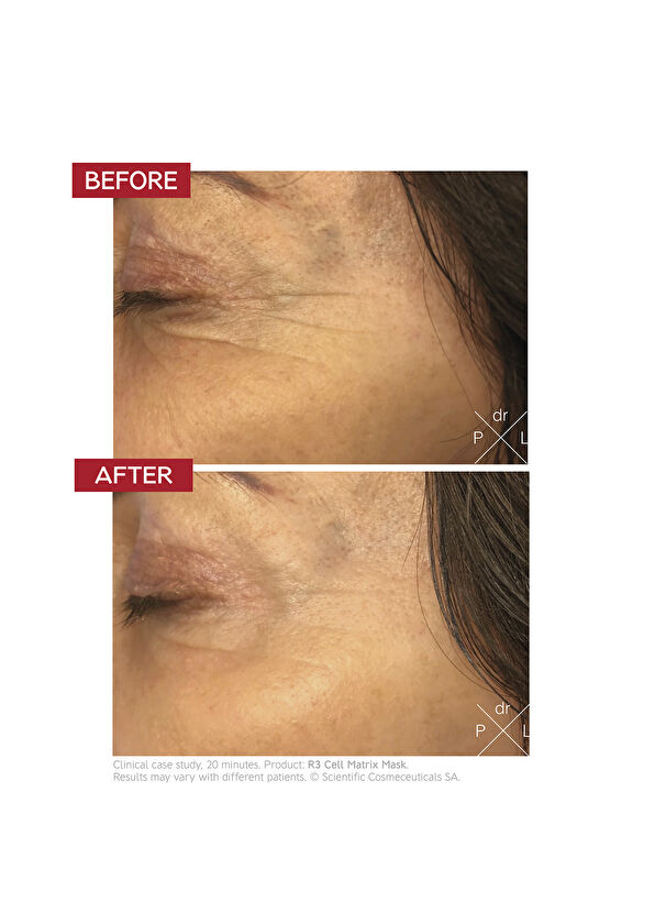 Dr.Levy R3 Cell Matrix Mask 50 ML - 4