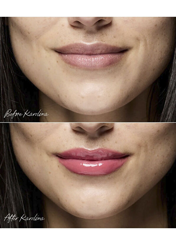 RMS Beauty Legendary Lip Oil Pembe Nemlendirici Parlatıcı Dudak Yağı 5 ml - 3