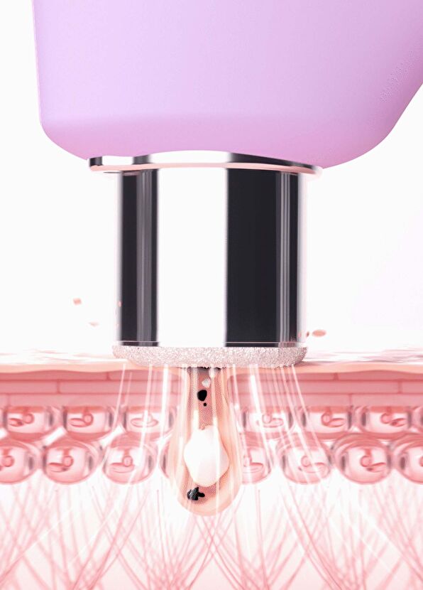 Foreo Kiwi Derma Skin Massager - 3