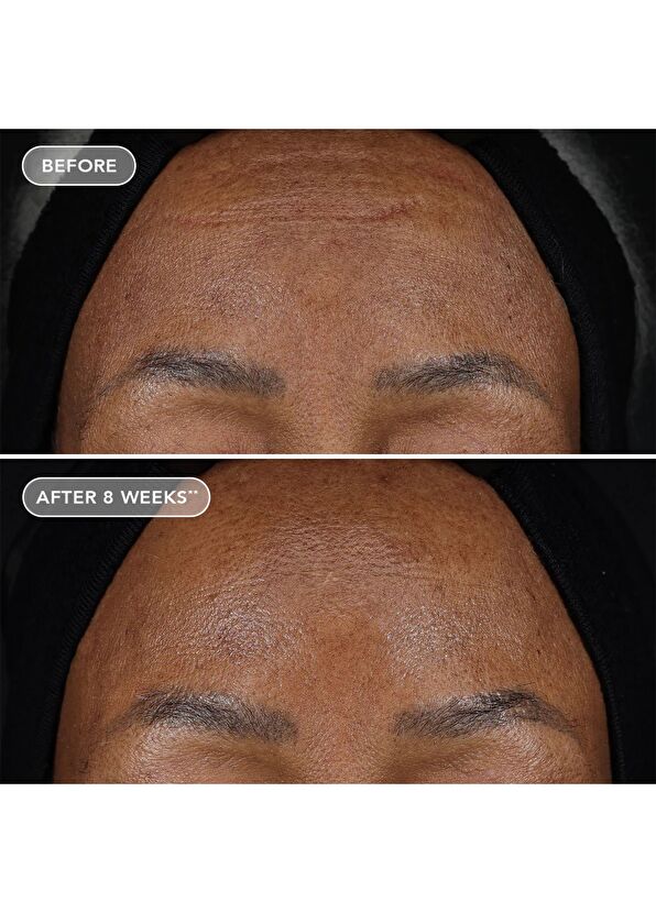 Image Skincare Ageless+ Retinol Treatment Crème 1.2% Retinol Complex Anti-Aging Face Cream 28.5 gr - 4