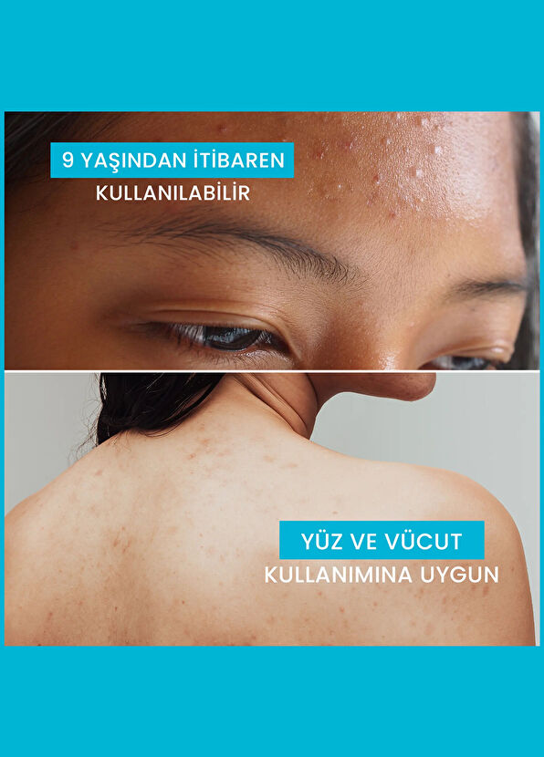 Ducray Keracnyl Gel Cleansing Gel for Oily and Acne-Prone Skin 400 ml - 4