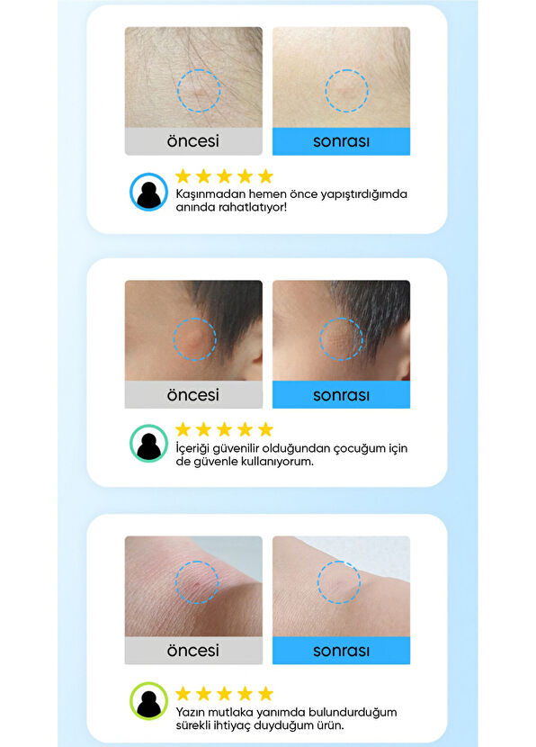 ACROPASS Soothing Care Microcone Patch 12’li Yatıştırıcı ve Önleyici Mikro İğneli Bant  - 3