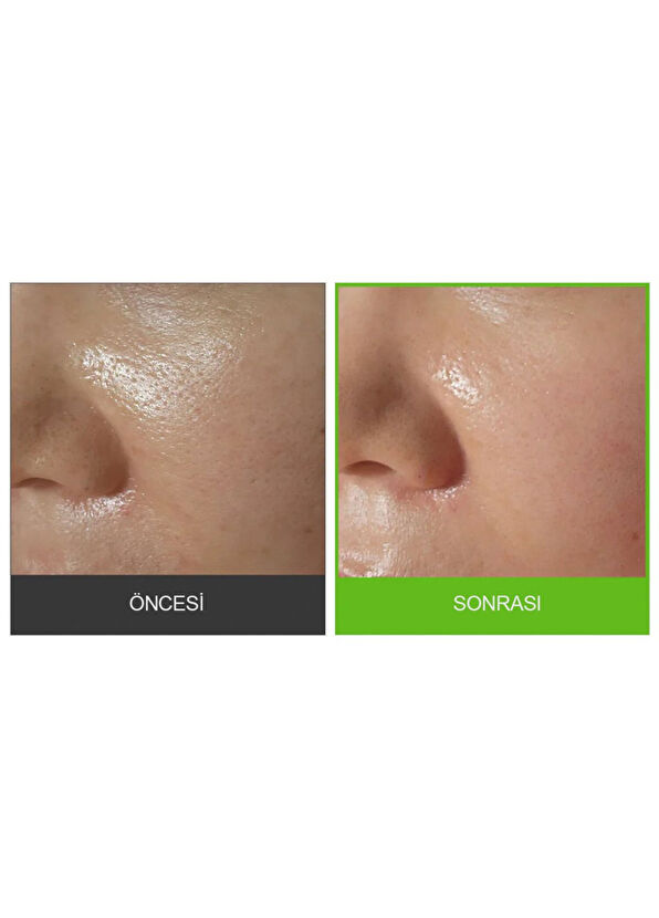 Sungboon Editor Green Tomato Pore Peeling Jumbo Pad Purifying and Moisturizing 60 Pieces Peeling Pad 180 ml - 3