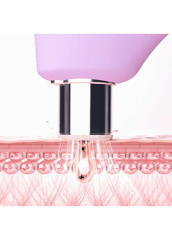 Foreo Kiwi Derma Skin Massager - 3