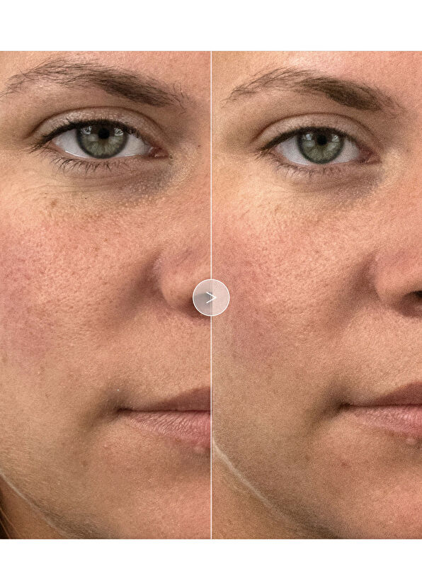 Noble Panacea The Brilliant Radiant Resilience Moisturizer 30 Do - 4