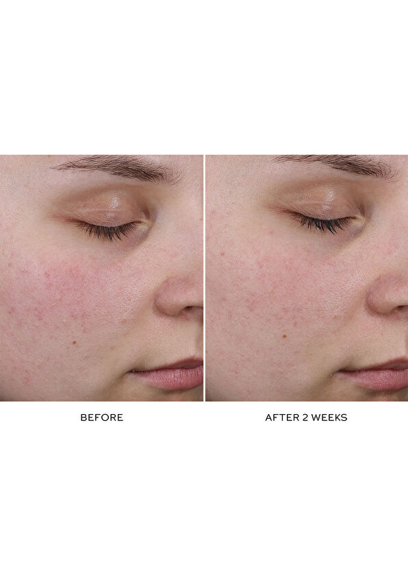 Westman Atelier Pore Refining Complex Serum - 2