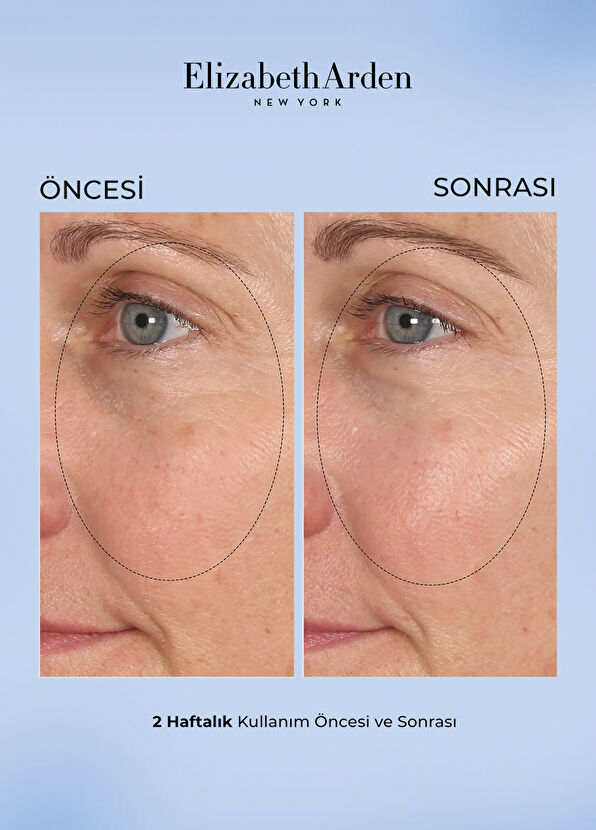 Elizabeth Arden Visible Brightening Spot Correcting Dengeleyici 60'lı Gece Cilt Bakım Kapsülü - 4