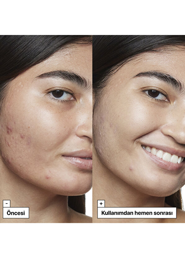 Dr.Jart+ Cicapair Tiger Grass Tiger Grass Liquid Trimmer - 4