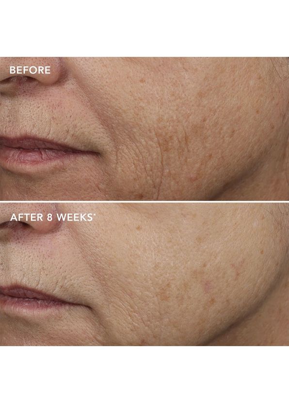 Image Skincare Ageless+ Retinol Overnight Masque 0.5% Retinol Complex Anti-Aging Face Cream 50 gr - 4