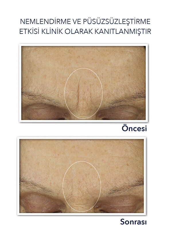 Roc Retinol Correxion Kırışıklık Karşıtı Nemlendirici Yüz Kremi 50 ml - 4