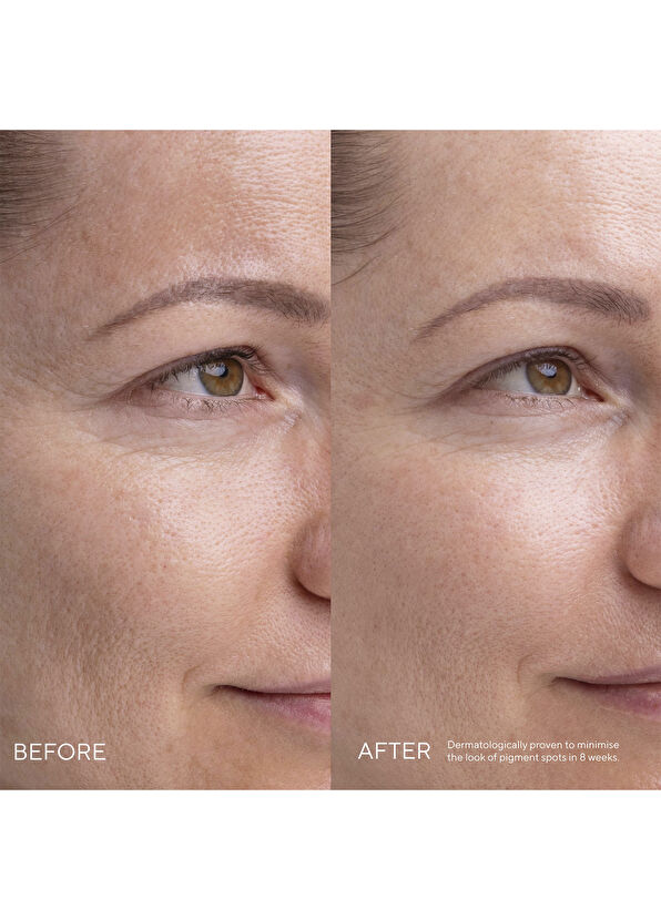 Mádara KOJIC ALTERNATIVE Kojic Acid Alternative Plant-Based Pigment Serum - 2