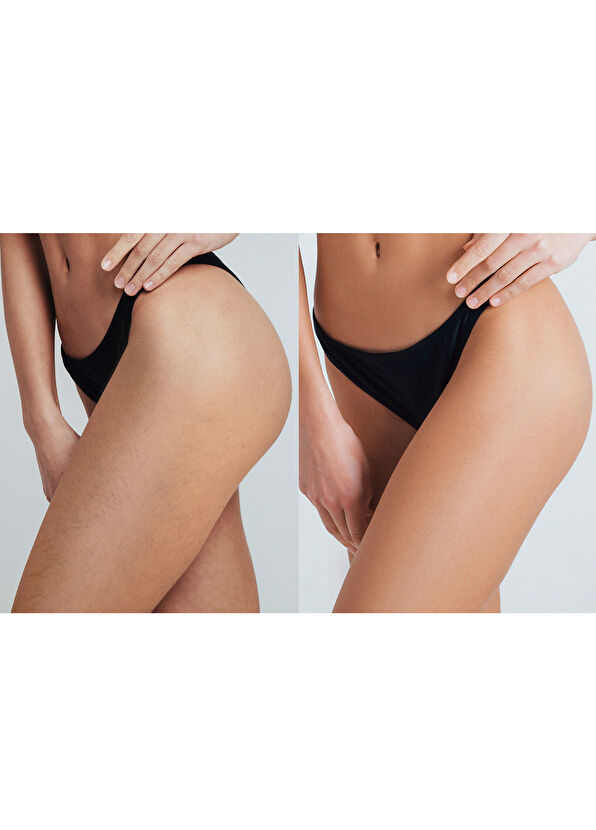 Foreo Peach 2 pro max ıpl hair removal hair removal devi - 3